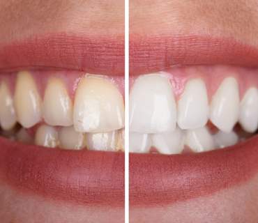 odontologos en el huila