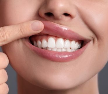 tratamientos odontologicos neiva